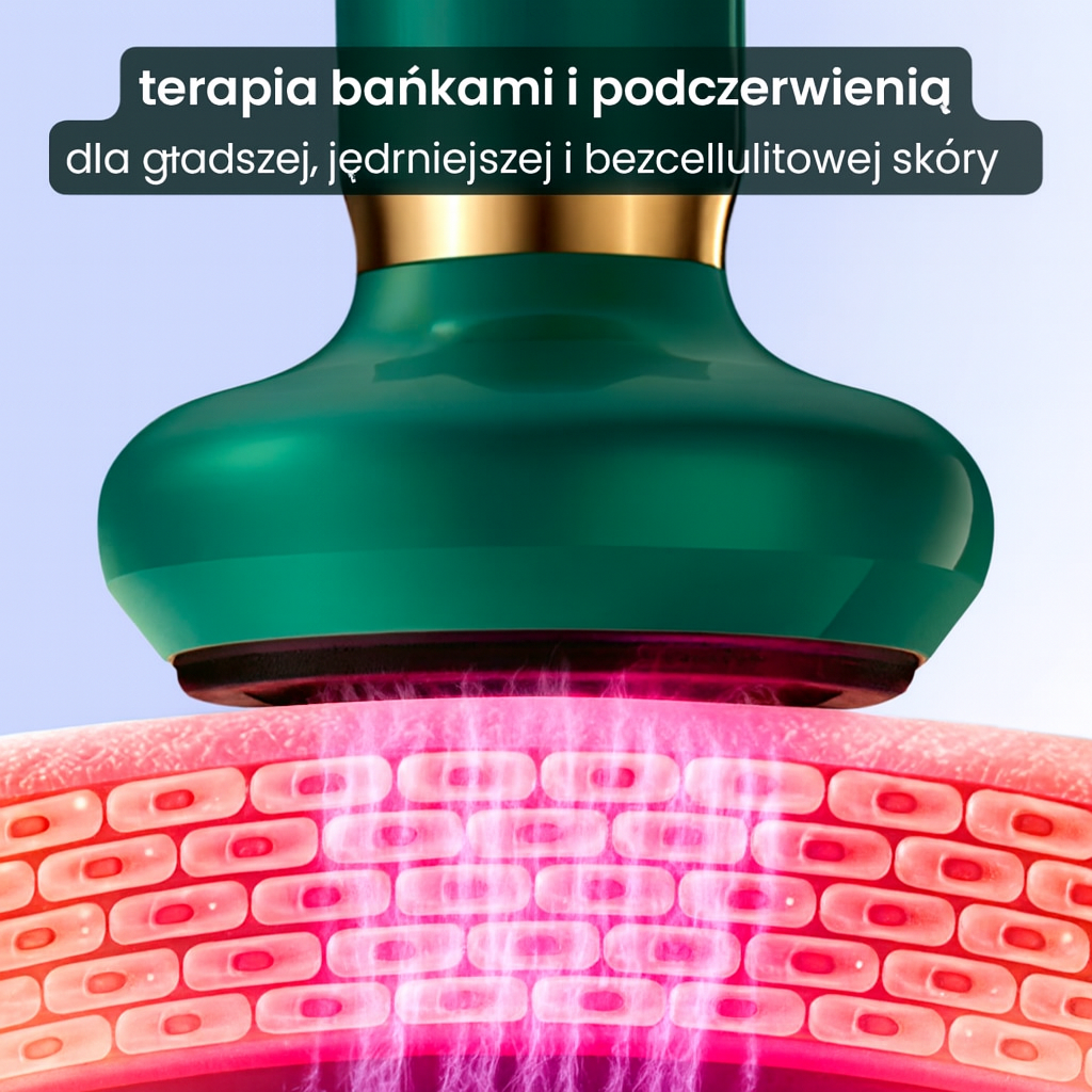 SculptEase – zabieg na cellulit 4 w 1