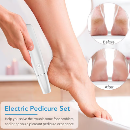 💥Limited-Time Offer 66% OFF🔥⚡Electric Callus Remover for Feet